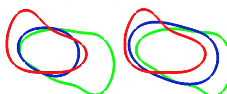 Fig. 3. Zero level-set of the solutions (ϕ(x, T)) computed using the approximated optimal control (η∗) with and without the volume constraint for the experiments of Section 4.2