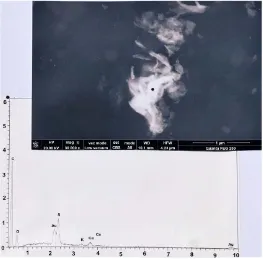 Figure 13. A third plaque of gold, located on hair number 1. Above: SEM photograph (in CBS, 20000×) of the plaque