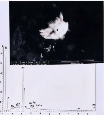 Figure 9. A particle of gold, located on hair number 2. Above: SEM photograph (in CBS, 20000×) of the particle