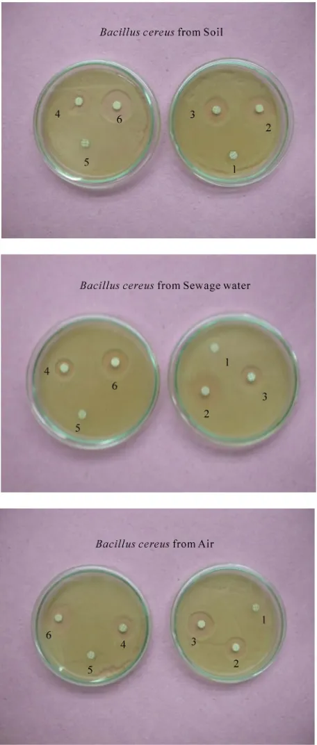 Figure 3. Antibiotic resistance/sensitivity spectrum of Bacillus cereus isolate from diverse sources