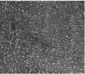 Figure 1(b) Duplex Phase structure produced by intercritical annealing at 760 0C for 30 minutes then water quenching