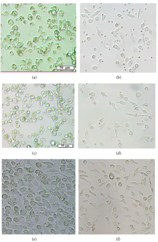 Table 2. Quantification of mRNA ABCA1, ABCG1, SRB1 in cultured macrophage. 
