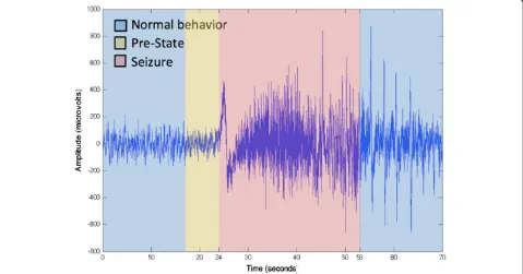 Figure 2 shows an example of an EEG signal including aseizure period. It is clear that there is a difference be-tween seizure and non-seizure intervals