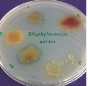 Figure 3. Formation of inhibitory zone of Staphylococcus aureus (ATCC29213) around amniotic tissue 