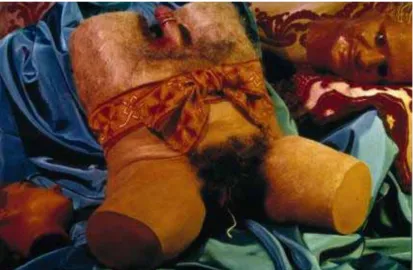 Figure 2. Cindy Sherman. Untitled #263, 1993. 