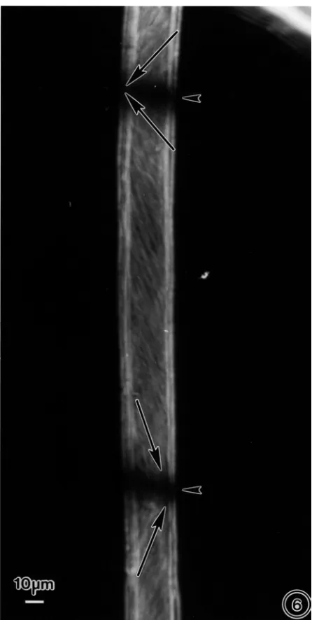 Fig. 6. An indole-3-acetic acid-treated fiber at 50 d post-anthesis exhibits both a Z reversal (top) and an Sreversal (bottom)