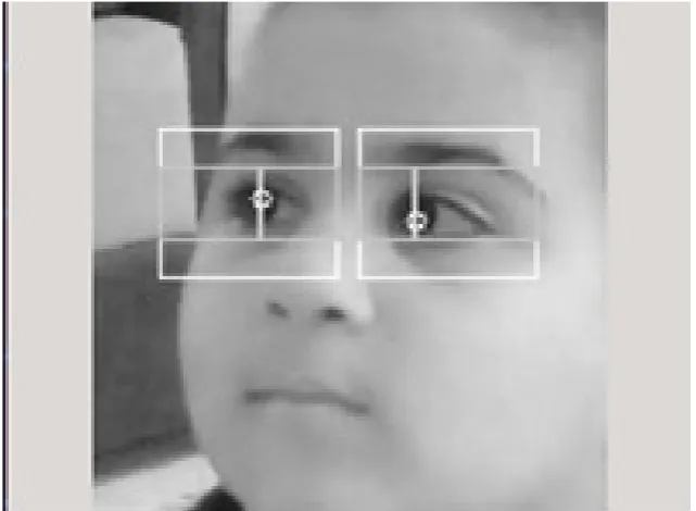 Figure 3).Figure 3. Diagnosis of eyes and pupils in Fabian Timm’s algorithm