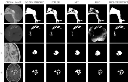 Table 2.  Performance analysis for seed selection on all four 3D image datasets