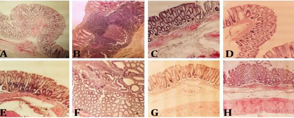 Fig. 2. sizes are seen on the mucosal surface, the ulcers are so extensive that denudation of mucosal layer is evident and the bowel wall is 