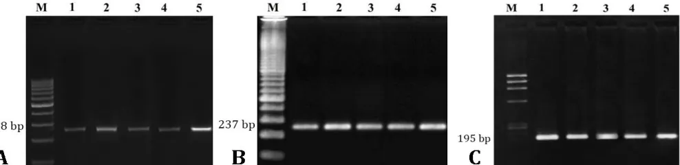 Fig. 1. PCR products of amplified genes visualized on agarose gel A) β1-integrin (288 bp), B) thy-1 (237 bp) and C) NANOG (195 bp) gene primer