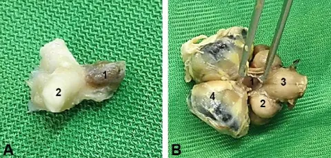 Fig. 1. A) Dorso-lateral view of the pituitary gland in adult turkey. 1: Pituitary gland; 2: Optic nerve