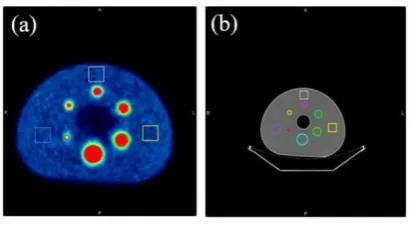 Fig 1. NEMA 2012/IEC 2008 phantom positioning during the image acquisition using the GE Discovery ST