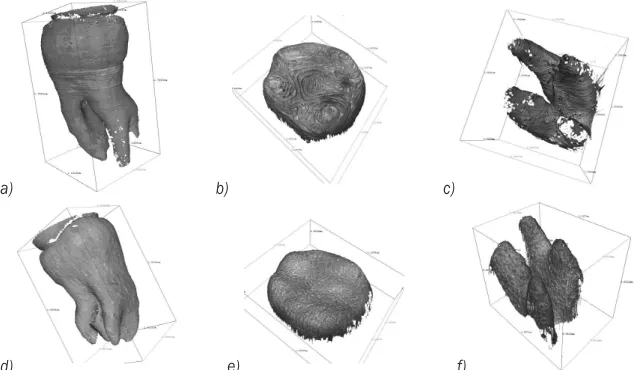 Fig. 5.  Scanned point clouds of the FDM model of the tooth 1: a) side surface, b) top surface,  and of the 3DP model of the tooth 1: c) side surface, d) top surface