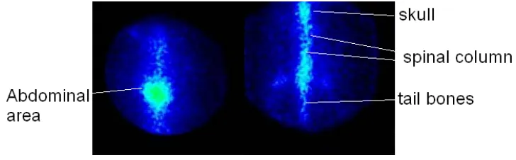 Figure 8. SPECT images of 153Sm-TTHMP (right) and 153Sm (left) 24 h post injection in wild-type rats