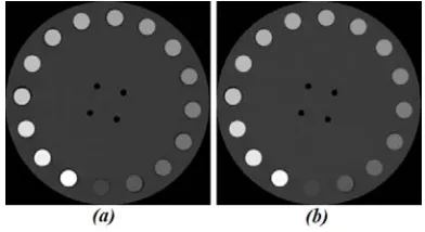 Figure 7 shows difference images obtained by subtracting generated µmap images using the bilinear and virtual DECT techniques and the reference image