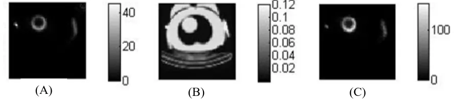 Figure 2: image, B: Attenuation map, C: Attenuation corrected image.  Images of slice 32 of scan with 1mCi of heart activity, breast b1 and bolus f1