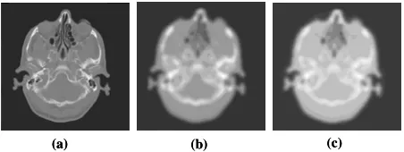 Figure 4. Principle of CT-based attenuation correction method on commercial PET/CT scanners
