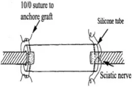 Fig 1. End-to-end anastomosis of silicone tube to the stumps of transected sciatic nerve