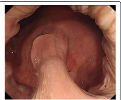 Fig. 1 Sagittal view of pelvic MRI. a Before imatinib treatment, an 80-mm tumor was observed on the anterior wall of the lower rectum