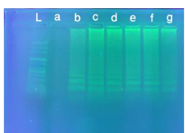 Fig. 3:  Sequence alignment of PCR band obtained in present study in comparison with database FhCM1-F