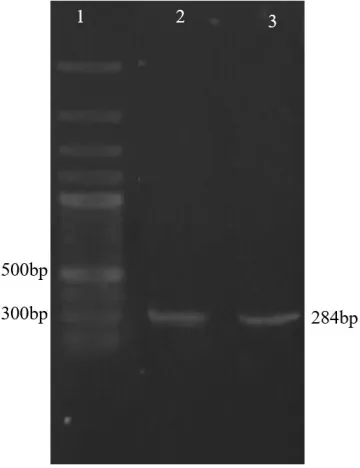 Fig. 9:  Confirmation of pX-Leish efficiency. A) Agarose Gel detection of PCR amplicon resulted from MMEJ