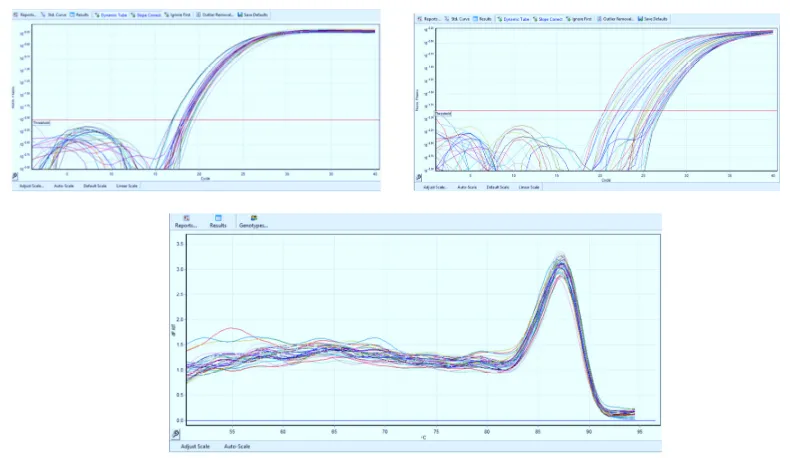 Figure 2. A and B the expression curve for MIR29A and CTGF (different concentrations of miR-29a and CTGF respectively) and GAPDH melting curve are indicated here (C)