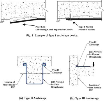 Fig. 2 Example of Type I anchorage device.
