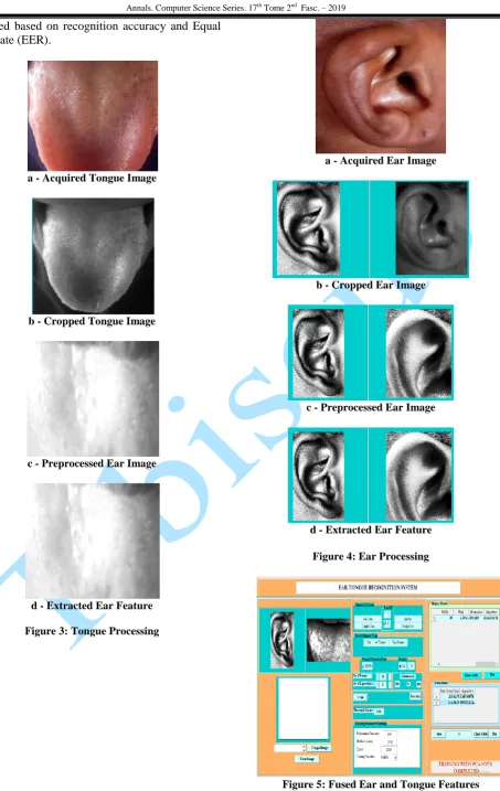 Figure 4: Ear Processing   