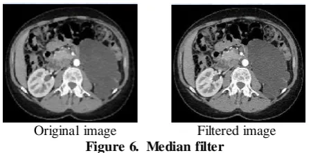 Figure 5. Principal technique SVM  