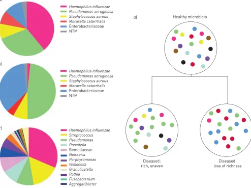 FIGURE 2 The microbiology of bronchiectasis.microbiology results from the US Bronchiectasis Registry [43];(hypothetical data based on published work) [45] (low-abundance genera (<1%) such as a) Culture-based microbiology results from a European cohort stud
