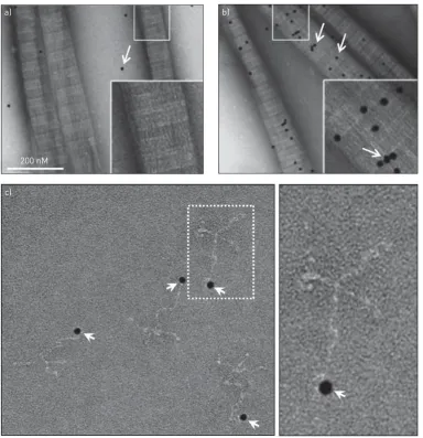 FIGURE 1 a and b) Moraxella catarrhalisbind to collagen I fibrils, whereasTransmission electron microscopy (TEM) demonstrates that ubiquitous surface protein (Usp) A2 binds collagen with high affinity