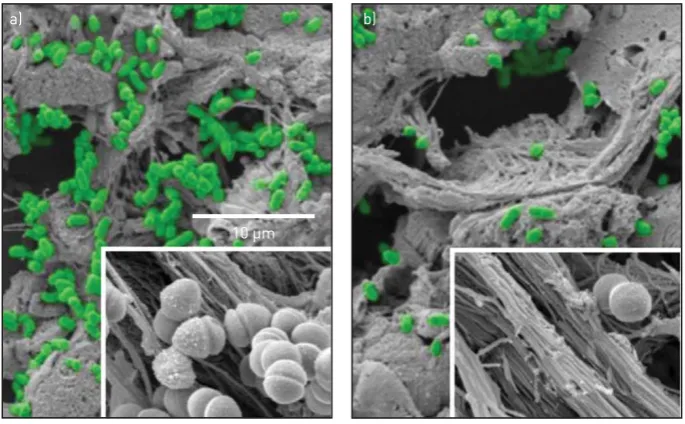 FIGURE 3 Scanning electron micrographs showingpseudocolour) adhere to human tracheal specimens, whereasthata) Moraxella catarrhalis bacteria (in green b) UspA2-deficient mutants do not
