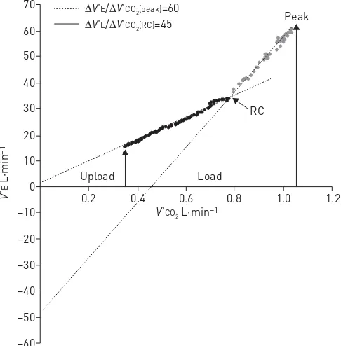 FIGURE 1 The minute ventilation (V′E)/carbon dioxide production (V′CO2) relationship slope in two pulmonaryarterial hypertension patients