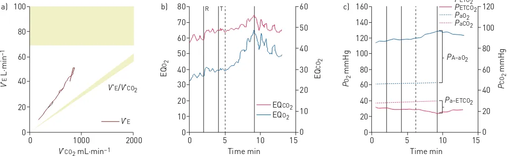 FIGURE 1 Cardiopulmonary exercise testing of a patient with chronic thromboembolic pulmonary hypertension showing fields 4, 6 and 9 of theWasserman panel