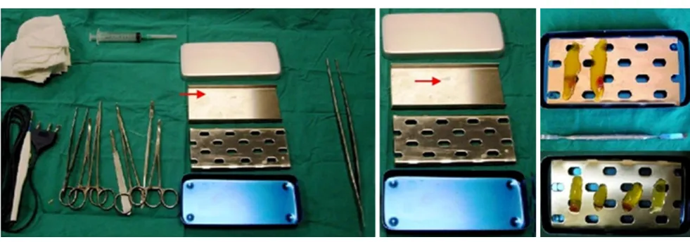 Figure 2: L-PRF Wound Box®