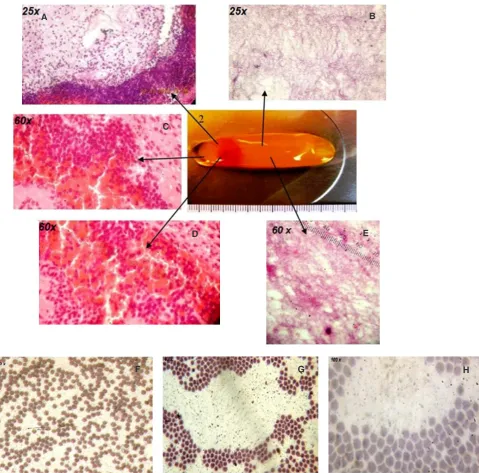 Figure 5: Membrane L-PRF of 60 min by the compression horsepower (hematoxylin-eosin staining)