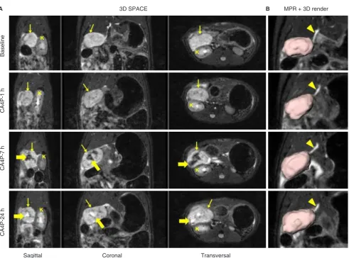 Figure 3: Non-invasive longitudinal follow up using 3D T2-weighted SPACE in a rat study on tumors, where an orthotopic pancreatic head tumor (thin arrow) was treated with a vascular disrupting agent CA4P