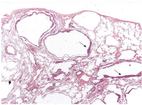 FIGURE 1. Surgical lung biopsy showing several thin-walled rounded cysts ofvarying dimensions