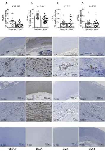 Figure 2 Immunostaining of C5aR2, αSMA, CD3 and CD68 in aortic media of TAA patients compared with controls