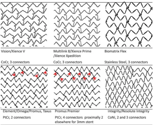 Figure 1 Technical requirements of coronary stents. The ideal coronary stent requires compromise in desirable characteristics
