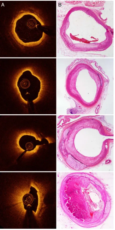 Figure 2Examples of matched OCT and histology images.OCT, optical coherence tomography.