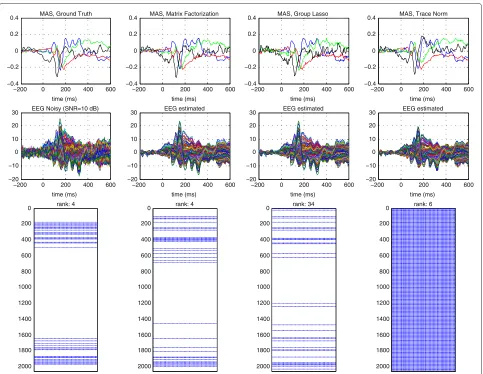 Figure 2 Simulation results: waveforms of the MAS, EEG estimated, and sparsity pattern of the estimated BES matrix