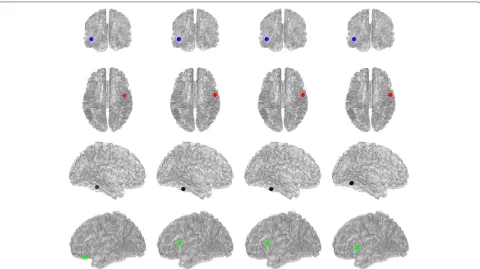 Figure 3 Localization of the MAS, N = 413 sources. From left to right: Ground Truth, Matrix Factorization, Group Lasso, and Trace Norm.