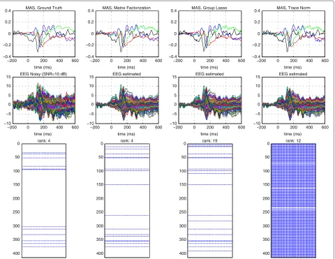 Figure 1 Simulation results: waveforms of the MAS, EEG estimated, and sparsity pattern of the estimated BES matrix