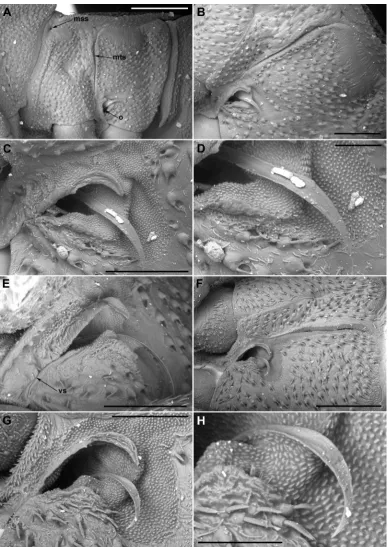 Fig. 3. External scent efferent system of metathoracic glands in Hyocephalidae. A–E – Hyocephalus aprugnusA – meso- and metathorax, lateral view (magni(180×); D – peritreme, lateral view (300×); E – ostiole and peritreme, ventral view (180×)