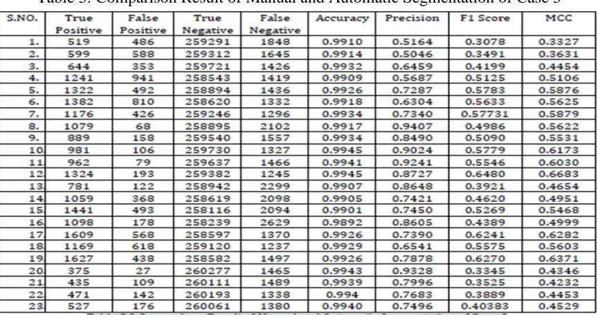 Figure 2: Histogram of Accuracy of Case 2  