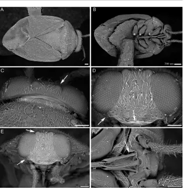 Fig. 3. Scanning electron micrographs of Isometopus linnavuorii sp. nov.: A – body in dorsal view; B – body in ventral view; C –head in dorsal view; D, E – head in frontal view; F – head in fronto-ventral view