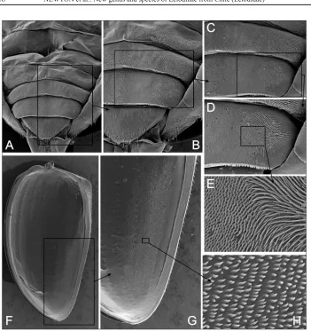 Fig. 4. Anaballetus chilensis gen. & sp. nov., female paratype; abdominal-elytral binding patches