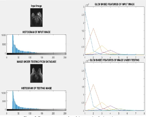 Fig.4, 5 represents proposed work in execution for input image and the corresponding output