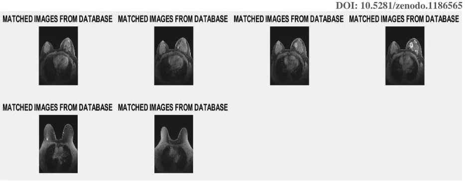 Figure 6: Represents output of the proposed corresponding to the input image 